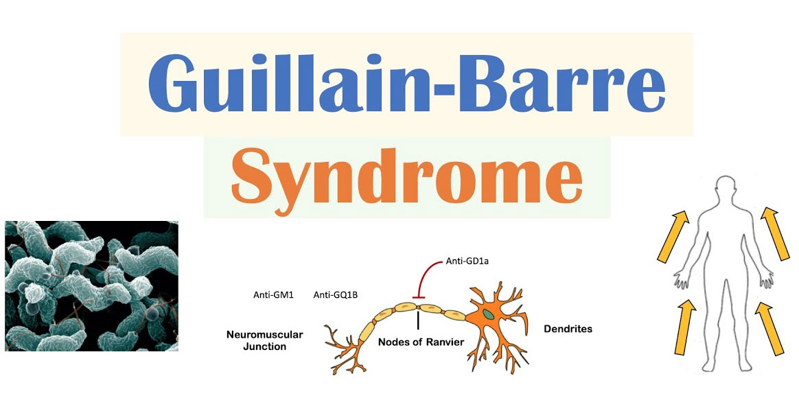 Guillain-Barré Syndrome